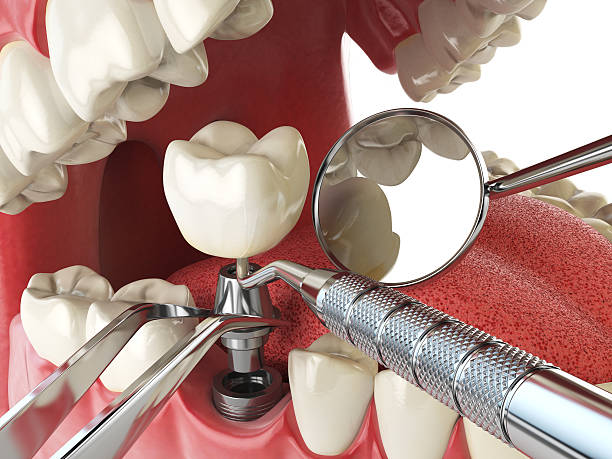 Best Root Canal Emergency Dentist  in Manito, IL